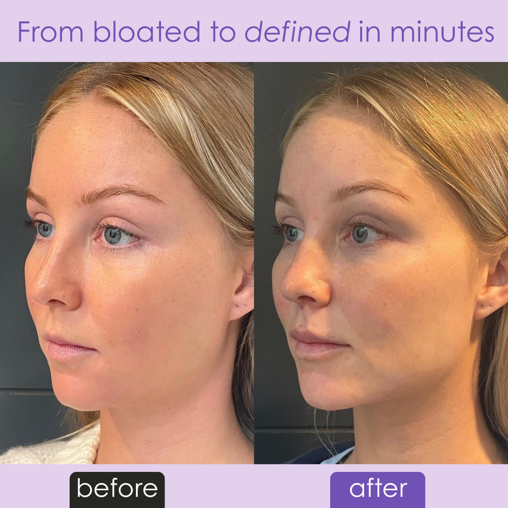 Uplift Massaging Beauty Roller